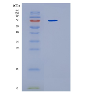 Recombinant Human HSP70 (amino acids 1-641) Human Protein