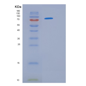 Recombinant Human HSP90 (amino acids 1-732) Protein,Recombinant Human HSP90 (amino acids 1-732) Protein