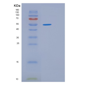 Recombinant Human HSPA13 Protein,Recombinant Human HSPA13 Protein