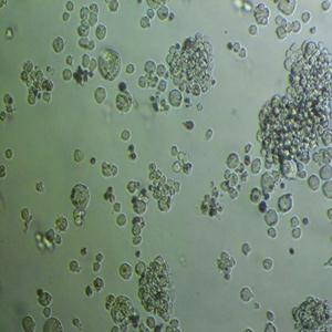 NCI-H23人非小细胞肺癌细胞
