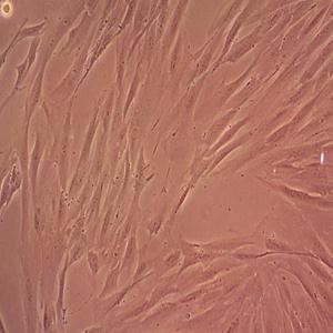 NCI-H1993人肺腺癌细胞