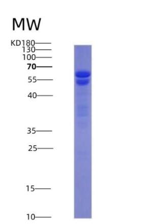 Recombinant Nuclear Mitotic Apparatus Protein 1 (NUMA1),Recombinant Nuclear Mitotic Apparatus Protein 1 (NUMA1)