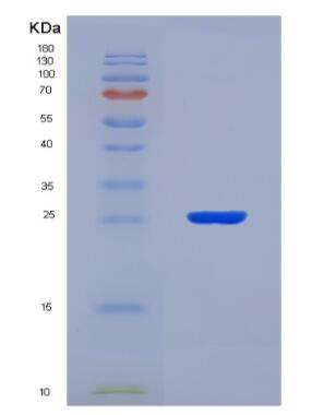 Recombinant Bovine Xanthine Dehydrogenase (XDH),Recombinant Bovine Xanthine Dehydrogenase (XDH)