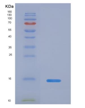 Recombinant Human Interleukin-5 (IL5) Protein,Recombinant Human Interleukin-5 (IL5) Protein