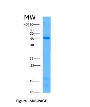 Recombinant Human Calnexin (CNX),Recombinant Human Calnexin (CNX)