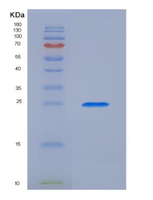 Recombinant Prorelaxin 1 (REL1),Recombinant Prorelaxin 1 (REL1)