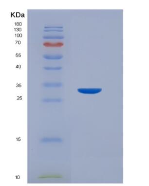 Recombinant Human Collagen Type VII (COL7),Recombinant Human Collagen Type VII (COL7)