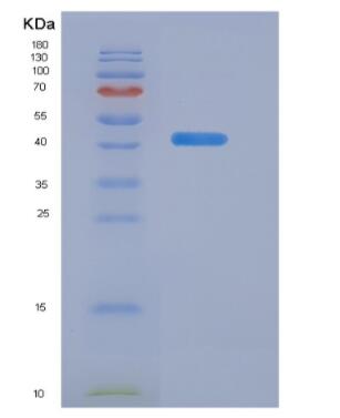 Recombinant Major outer membrane porin(ompA),Recombinant Major outer membrane porin(ompA)