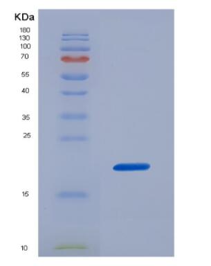 Recombinant Mouse Interleukin 17B (IL17B),Recombinant Mouse Interleukin 17B (IL17B)