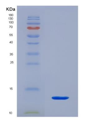 Recombinant Neuregulin 4 (NRG4),Recombinant Neuregulin 4 (NRG4)