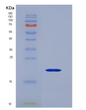 Recombinant Cytochrome P450 1B1 (CYP1B1),Recombinant Cytochrome P450 1B1 (CYP1B1)