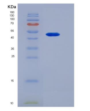 Recombinant Platelet/Endothelial Cell Adhesion Molecule (PECAM1),Recombinant Platelet/Endothelial Cell Adhesion Molecule (PECAM1)