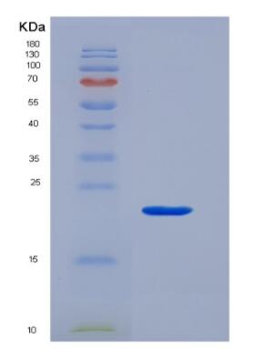 Recombinant Von Willebrand Factor (vWF),Recombinant Von Willebrand Factor (vWF)