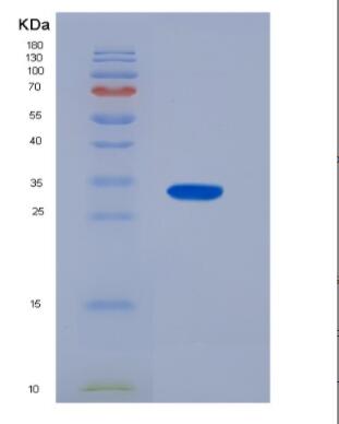 Recombinant Tissue Factor (TF),Recombinant Tissue Factor (TF)