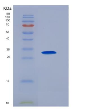 Recombinant Luteinizing Hormone (LH),Recombinant Luteinizing Hormone (LH)