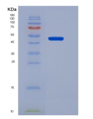 Recombinant Mdm2 p53 Binding Protein Homolog (MDM2),Recombinant Mdm2 p53 Binding Protein Homolog (MDM2)