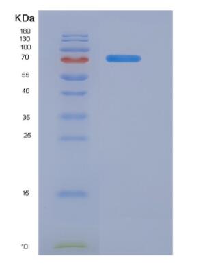 Recombinant Alpha-Fetoprotein (AFP),Recombinant Alpha-Fetoprotein (AFP)