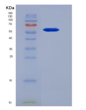 Recombinant Mouse Netrin 1 (Ntn1),Recombinant Mouse Netrin 1 (Ntn1)