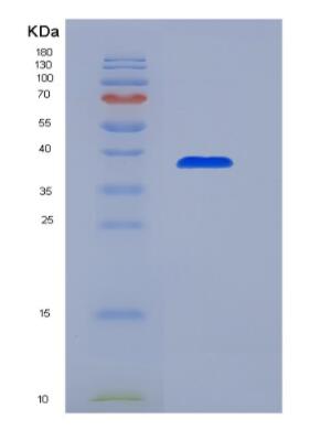 Recombinant Glucocorticoid Receptor (GR),Recombinant Glucocorticoid Receptor (GR)