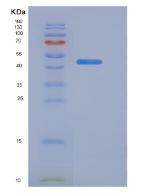 Recombinant Human Aquaporin 4 (AQP4) Protein,Recombinant Human Aquaporin 4 (AQP4) Protein