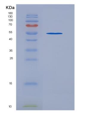 Recombinant Human TIE2 protein,Recombinant Human TIE2 protein