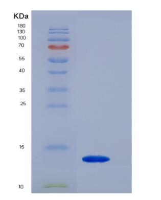 Recombinant rat IL-5 protein,Recombinant rat IL-5 protein