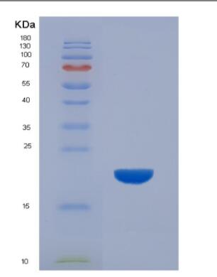 Recombinant Human TDP43 peptide,Recombinant Human TDP43 peptide