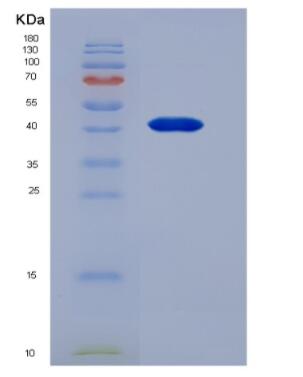 Recombinant Mouse Retnlb protein,Recombinant Mouse Retnlb protein