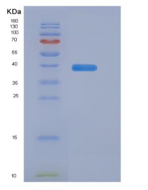 Recombinant Human Syncollin (SYCN) protein,Recombinant Human Syncollin (SYCN) protein