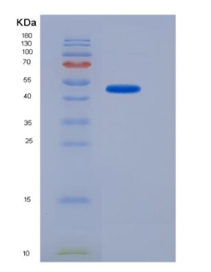 Recombinant Human Ubiquitin Specific Peptidase 7 (USP7) Protein,Recombinant Human Ubiquitin Specific Peptidase 7 (USP7) Protein