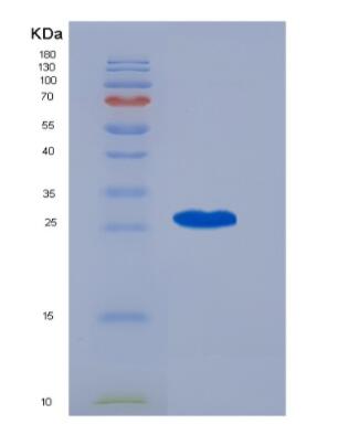 Recombinant Human CENPF protein,Recombinant Human CENPF protein