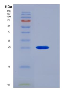 Recombinant Mouse Colony Stimulating Factor Receptor, Macrophage (MCSFR) Protein,Recombinant Mouse Colony Stimulating Factor Receptor, Macrophage (MCSFR) Protein