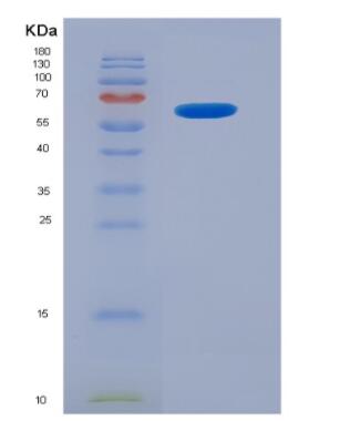 Recombinant Kallikrein 6 (KLK6),Recombinant Kallikrein 6 (KLK6)