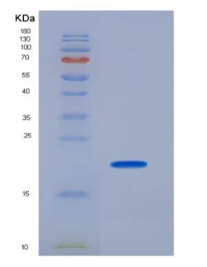 Recombinant Human Collagen Type XVII (COL17A1),Recombinant Human Collagen Type XVII (COL17A1)