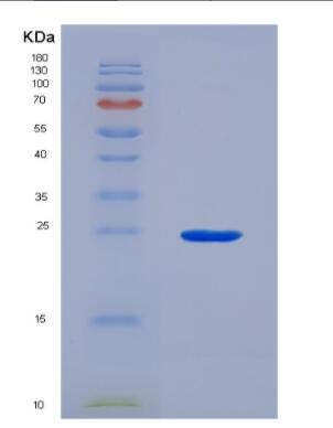 Recombinant Human Glutamate Cysteine Ligase, Catalytic (GCLC),Recombinant Human Glutamate Cysteine Ligase, Catalytic (GCLC)