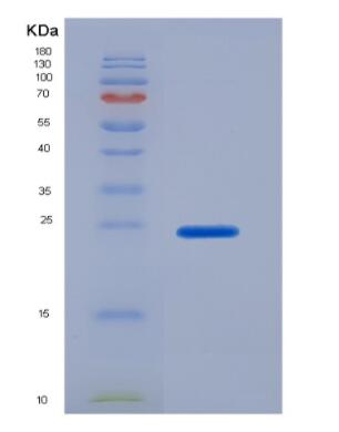 Recombinant Secreted Phosphoprotein 2 (SPP2),Recombinant Secreted Phosphoprotein 2 (SPP2)