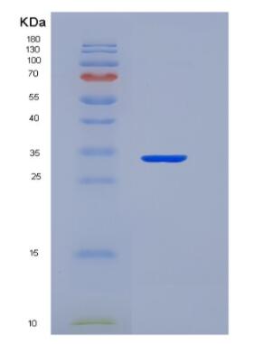 Recombinant TNF Receptor Associated Factor 6 (TRAF6),Recombinant TNF Receptor Associated Factor 6 (TRAF6)