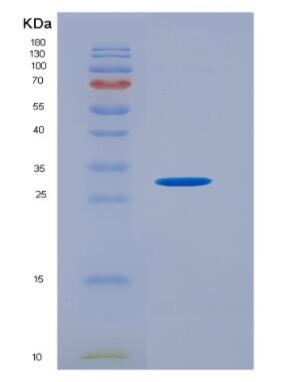 Recombinant Neutrophil Elastase (NE),Recombinant Neutrophil Elastase (NE)