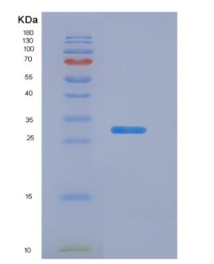 Recombinant Thyroid Hormone Receptor Beta (THRb),Recombinant Thyroid Hormone Receptor Beta (THRb)