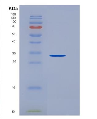 Recombinant Human Plasminogen (Plg) Protein,Recombinant Human Plasminogen (Plg) Protein