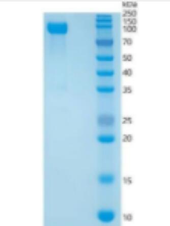 Recombinant Galactosidase Beta (GLb) Protein,Recombinant Galactosidase Beta (GLb) Protein