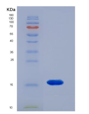 Recombinant Human FAM19A2 protein,Recombinant Human FAM19A2 protein