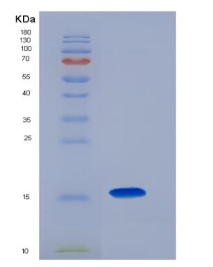 Recombinant mouse CCL28/MEC protein,Recombinant mouse CCL28/MEC protein