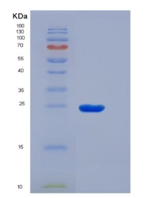 Recombinant Human Solute Carrier Family 30 Member 8 (SLC30A8) protein,Recombinant Human Solute Carrier Family 30 Member 8 (SLC30A8) protein