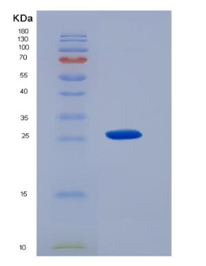 Recombinant Sigma non-opioid intracellular receptor 1 (SIGMAR1),Recombinant Sigma non-opioid intracellular receptor 1 (SIGMAR1)