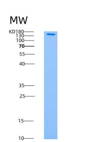 Recombinant Human AMPK (G1/B2/A2) Heterotrimer Protein,Recombinant Human AMPK (G1/B2/A2) Heterotrimer Protein