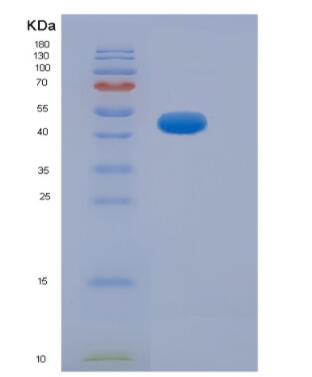 Recombinant Human Neurofilament, Heavy Polypeptide (NEFH),Recombinant Human Neurofilament, Heavy Polypeptide (NEFH)