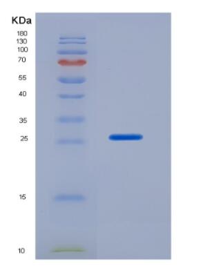 Recombinant Rat Hemopexin (HPX),Recombinant Rat Hemopexin (HPX)