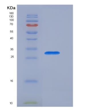 Recombinant Pulmonary Surfactant Associated Protein A1 (SFTPA1),Recombinant Pulmonary Surfactant Associated Protein A1 (SFTPA1)