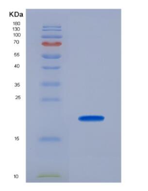 Recombinant Cytochrome C Oxidase Subunit II (COX2),Recombinant Cytochrome C Oxidase Subunit II (COX2)